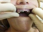 Смотреть фото Разное Протезирование и лечение зубов 34658208 в Москве